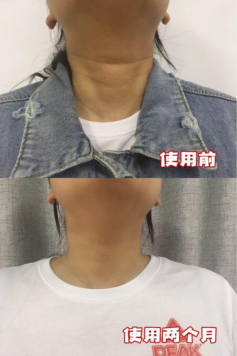 最新美容院儀器，重塑美麗的科技革新力量
